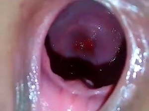 Hole Inspection